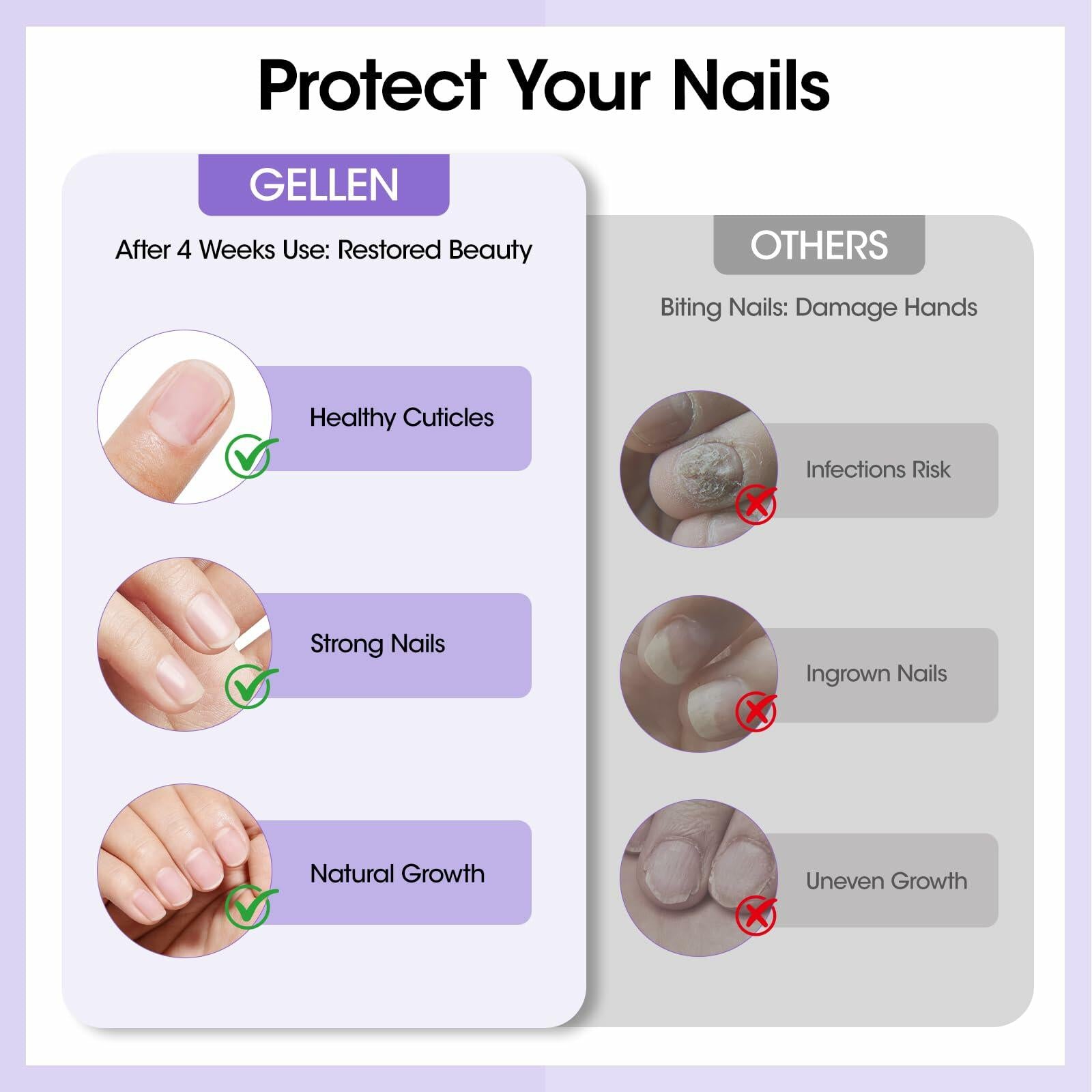 GELLEN Nail Biting Treatment Roll-On 10ml Quick Dry Water-Resistant
